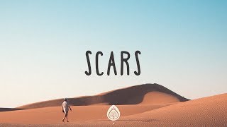 Scars